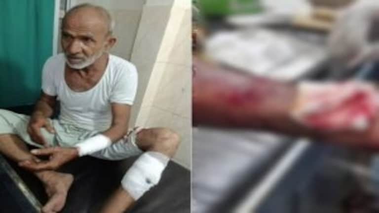 नोएडा में कुत्तों का आतंक, 60 वर्षीय बुजुर्ग हुए डॉग बाइट का शिकार, 20 से ज्यादा टांके आए UP Tak