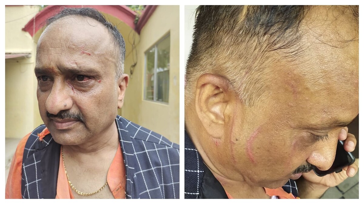यूपी में BJP नेता को रायफल के बट से पीटा? पुलिस अफसर के PRO पर दर्ज हुई FIR UP Tak