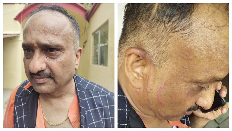 यूपी में BJP नेता को रायफल के बट से पीटा? पुलिस अफसर के PRO पर दर्ज हुई FIR UP Tak
