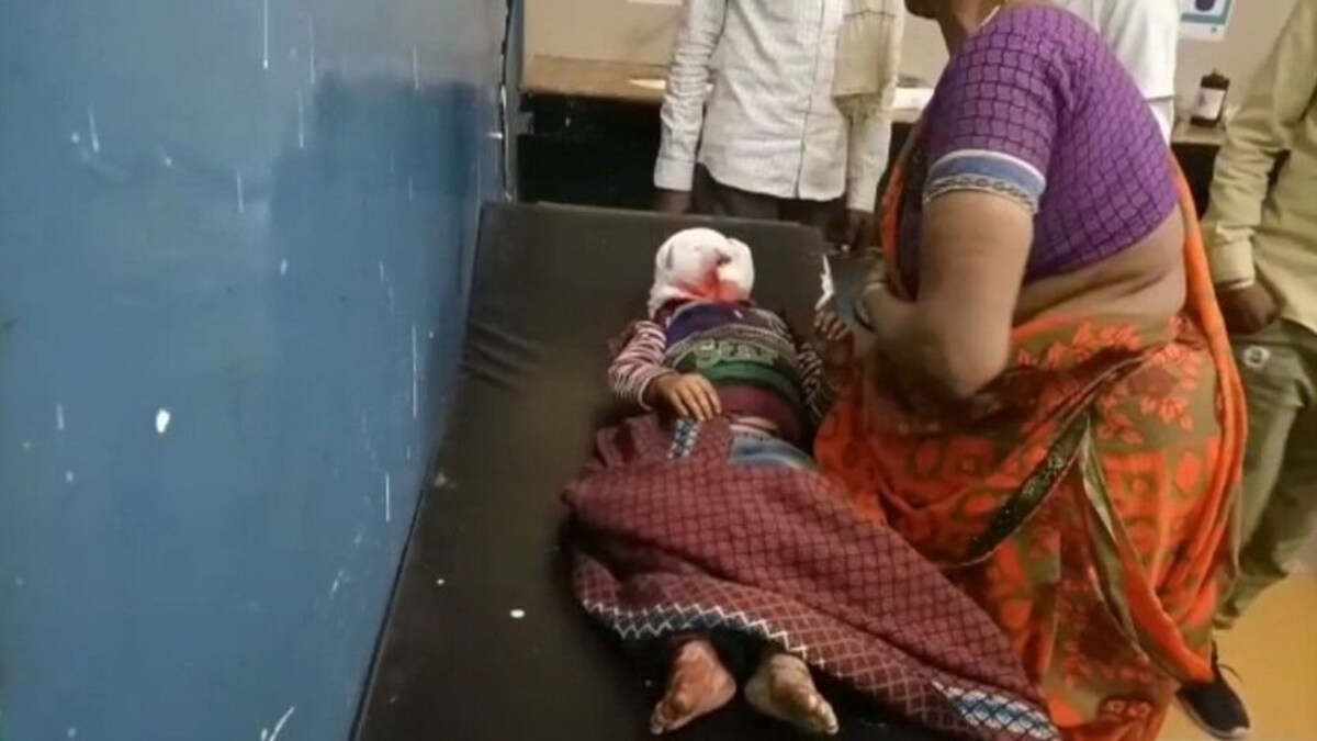 बांदा: एक और मासूम पर कुत्ते का जानलेवा हमला, चेहरे को किया लहूलुहान, अस्पताल में भर्ती UP Tak