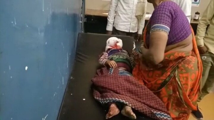 बांदा: एक और मासूम पर कुत्ते का जानलेवा हमला, चेहरे को किया लहूलुहान, अस्पताल में भर्ती UP Tak