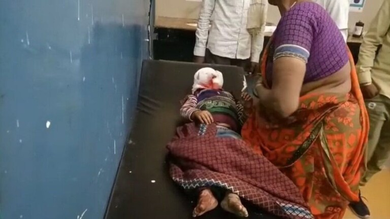 बांदा: एक और मासूम पर कुत्ते का जानलेवा हमला, चेहरे को किया लहूलुहान, अस्पताल में भर्ती UP Tak