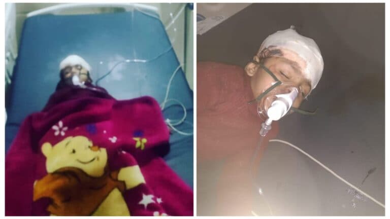 फिरोजाबाद: घर के बाहर खेल रही थी मासूम तभी बाइक ने मारी टक्कर और उसमें फंसी बच्ची, 500 मीटर तक घसीटा UP Tak