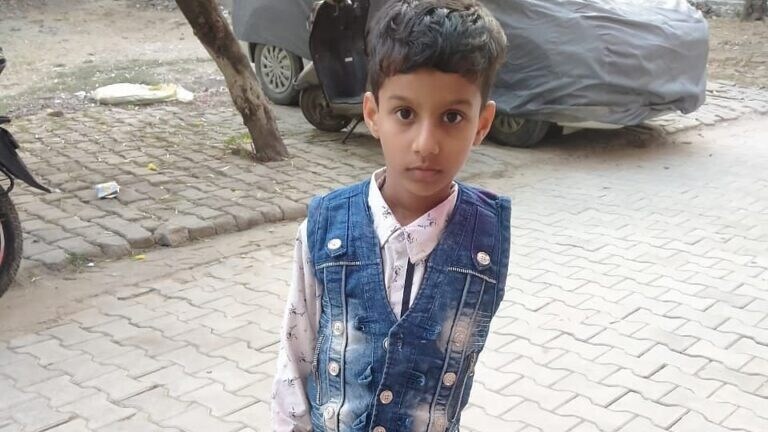 रितिक का दर्द: बिजली विभाग की लापरवाही से काटना पड़ा हाथ, अब सामने नई मुसीबत UP Tak