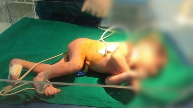 महराजगंज में पिछले 10 महीने में हुईं 111 शिशुओं की मौत, पर कैसे? ऐसे उठेगा रहस्य से पर्दा UP Tak