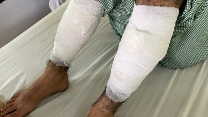 नोएडा: शादी से गन पॉइंट पर उठाकर युवक पर जानलेवा हमला, हालत गंभीर UP Tak