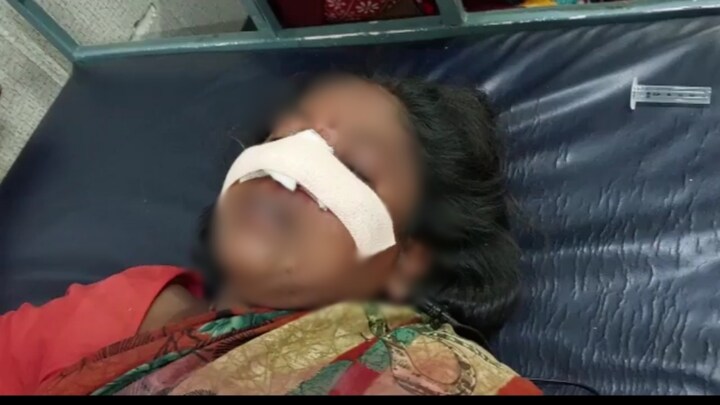 शाहजहांपुर: दरांती लेकर आया और बीच सड़क महिला की नाक ही काट दी, फिर ये कहानी पता चली UP Tak