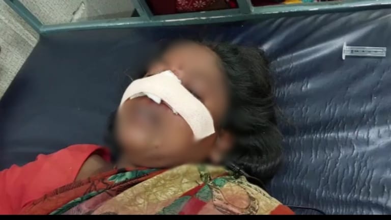 शाहजहांपुर: दरांती लेकर आया और बीच सड़क महिला की नाक ही काट दी, फिर ये कहानी पता चली UP Tak