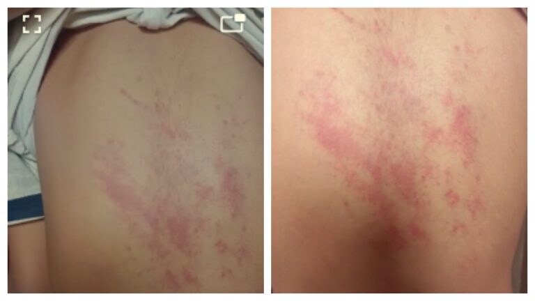 कानपुर में ड्रेस नहीं होने पर टीचर ने क्लास 3 की छात्रा को खूब पीटा, किसान पिता संग भी बदसलूकी UP Tak