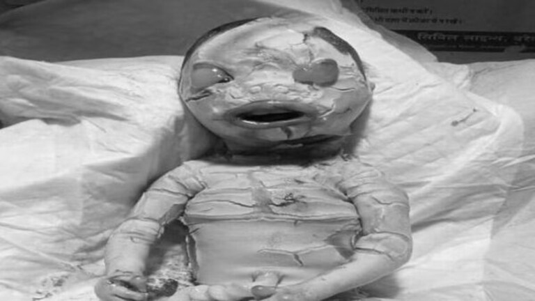 बरेली में बच्चे के जन्म के बाद डॉक्टर भी हुए हैरान, मासूम को देखकर परिवार में मचा कोहराम UP Tak