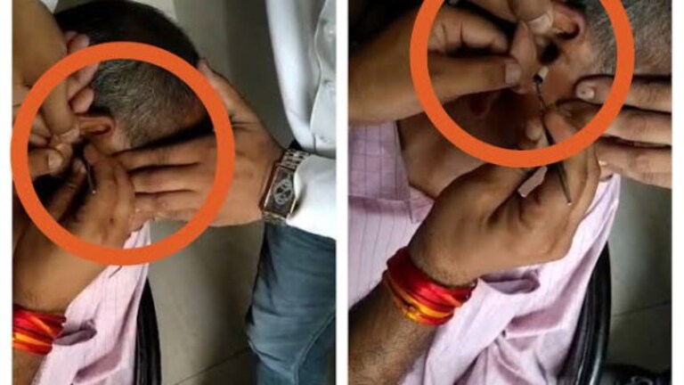कान में डिवाइस घुसाकर हो रही थी नकल! यूपी में सॉल्वर गैंग का ये कारनामा देख चौंक गए सभी UP Tak