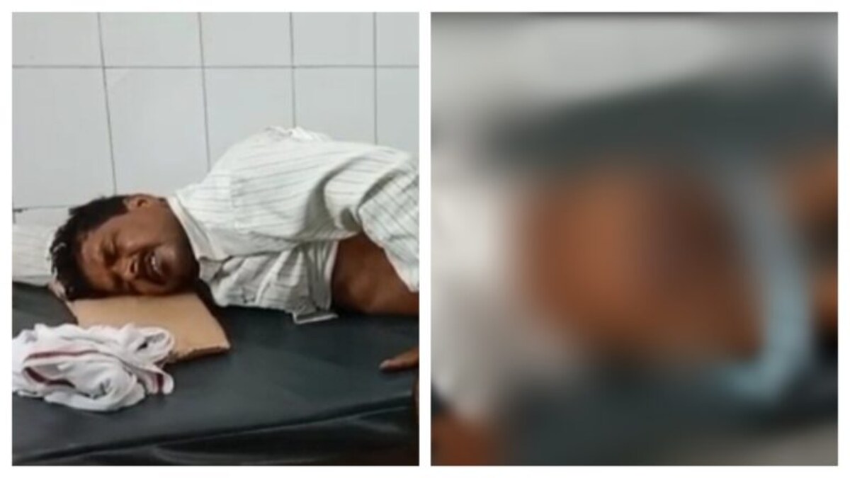 शाहजहांपुर: पुलिस ने मीट कारोबारी को इतना पीटा कि चोट की भयावह तस्वीर दिखाने लायक भी नहीं! UP Tak