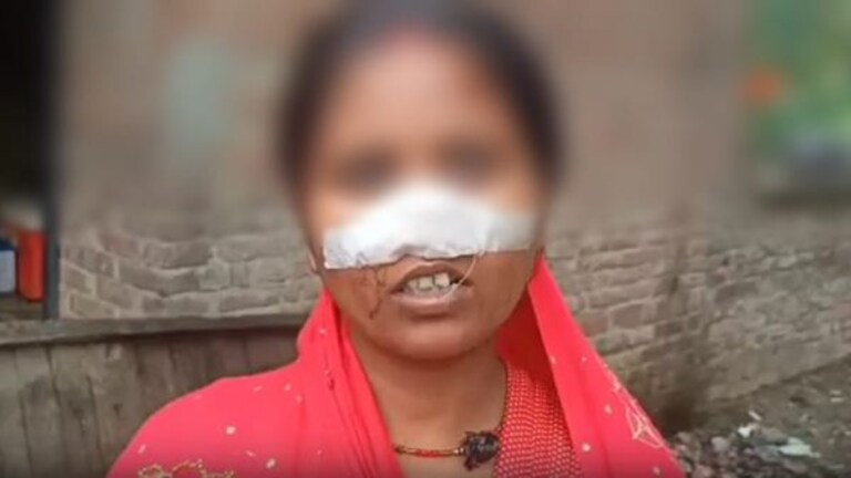 लखीमपुर खीरी: गर्लफ्रेंड के लिए पति ने काट दी पत्नी की नाक, महिला की हालत गंभीर UP Tak
