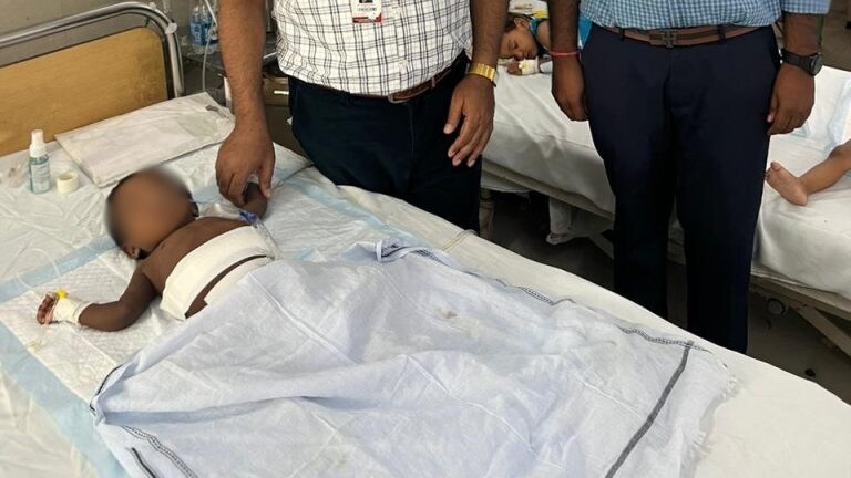 KGMU के डॉक्टरों ने 13 माह की बच्ची के पेट के अंदर से निकाला भ्रूण, विकसित हो गए थे हड्डी, बाल और आंत UP Tak