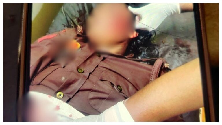 महिला कॉन्स्टेबल पर जानलेवा हमले में पुलिस के हाथ अब भी खाली, अब तक जांच में ये पता चला UP Tak