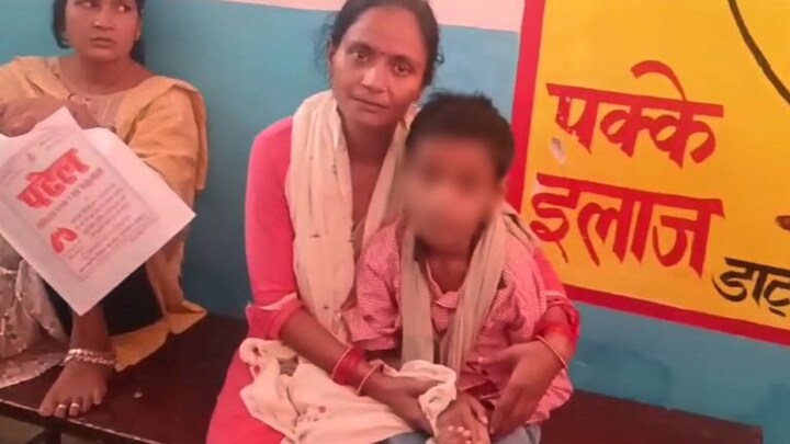 फतेहपुर: प्रिंसिपल छात्र को डंडे से मारता चला गया, मासूम का टूट गया हाथ, जानें मामला UP Tak