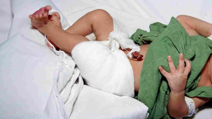 हाथरस: पेट दर्द की शिकायत पर अस्पताल पहुंची किशोरी, शौचालय में दिया बच्ची को जन्म, परिजन हैरान UP Tak