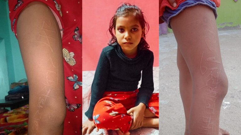 हरदोई में 8 साल की साक्षी के शरीर पर खुद लिख जाता है ‘राम-राम, राधे-राधे’, कैसे हो रहा ये सब? UP Tak