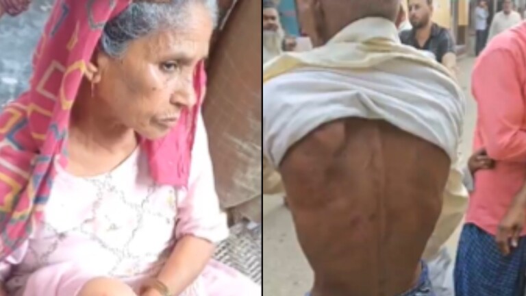 Sambhal Chunav 2024 : संभल में महिला के घूटने फटे तो बुजुर्ग की पीठ पर चोट! वीडियो दिखा सपा-कांग्रेस ने ये कहा UP Tak