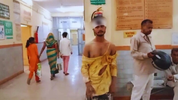 महिला को तोतली बोलने पर हुआ विवाद, घर में काम कर रहे मजदूर की ही लोगों ने कर दी पिटाई UP Tak