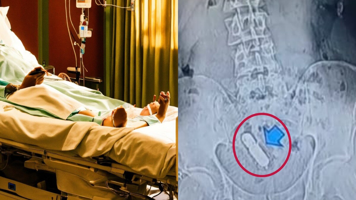 पेट में फंसा हुआ था सेक्स टॉय, फिर मरीज की ये कहानी सुनने के बाद डॉक्टर्स भी हैरान रह गए Ghaziabad, Ghaziabad News, Ghaziabad Viral News, UP Viral, Sex Toys, UP Viral News, UP Viral, Viral Video, UP News, News in hindi, Hindi News