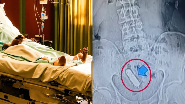 पेट में फंसा हुआ था सेक्स टॉय, फिर मरीज की ये कहानी सुनने के बाद डॉक्टर्स भी हैरान रह गए Ghaziabad, Ghaziabad News, Ghaziabad Viral News, UP Viral, Sex Toys, UP Viral News, UP Viral, Viral Video, UP News, News in hindi, Hindi News