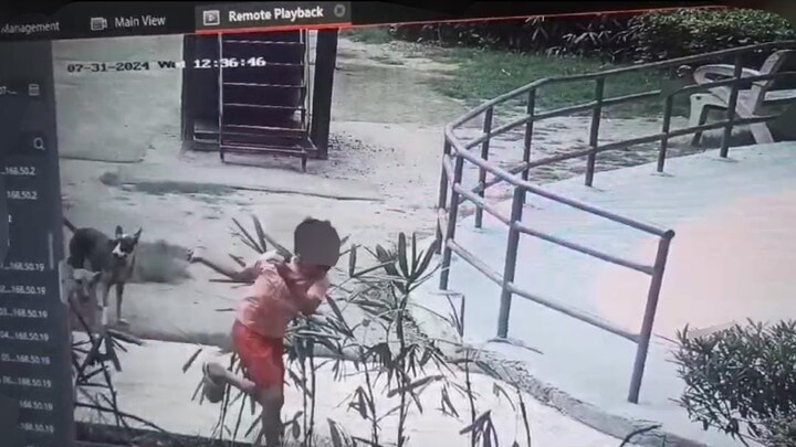 नोएडा : अजनारा होम्स सोसायटी के पार्क में खेल रहे मासूम पर स्ट्रीट डॉग्स का हमला, किया लहूलुहान...CCTV में कैद हुई घटना Noida News