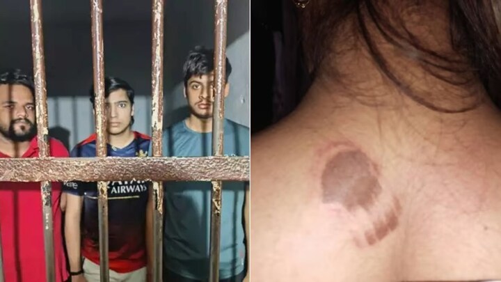 चेहरे, आंख, पीठ, जांघ पर बर्बरता के निशान, गाजियाबाद की इस लड़की का मंगेतर तो पूरा हैवान निकला Ghaziabad News