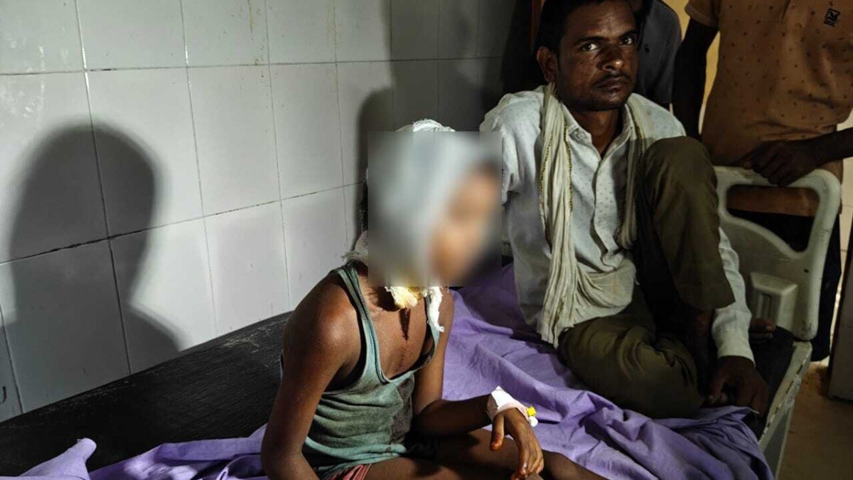 रात में बच्ची की आंख खुली और सामने खड़ा था खतरनाक भेड़िया... बहराइच में आदमखोर का एक और हमला Bahraich Woolf Attack News