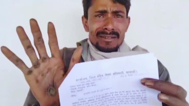 रिक्शा चलाकर मनोहर यादव के हाथों में पड़ गए छाले और इस गरीब को शिक्षा विभाग ने भेजा 51 लाख की वसूली का नोटिस! ये कहानी रुला देगी UP Tak