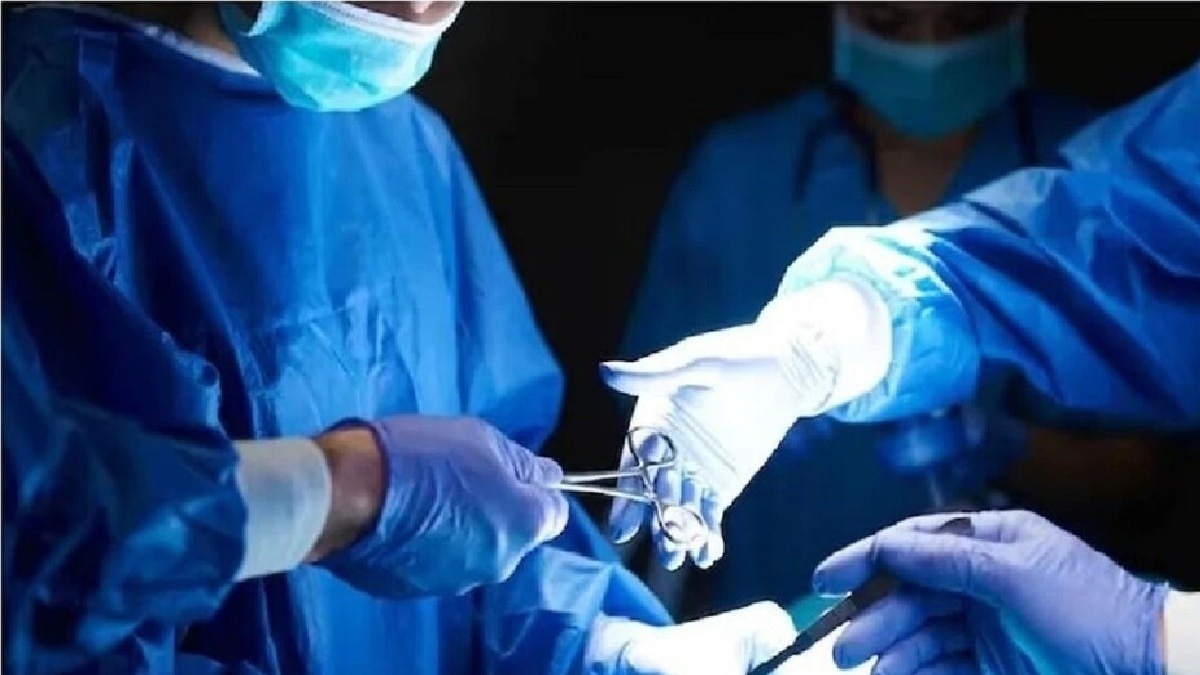 Meerut conjoined twins