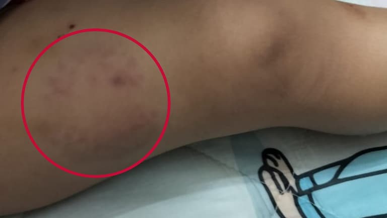 शर्मनाक! नोएडा के डे-केयर में 15 महीने की बच्ची के साथ जो हुआ, हर वर्किंग पेरेंट्स का दिल दहल जाएगा Noida daycare child abuse CCTV, 15 month baby beaten in daycare, maid caught hitting child Noida, CCTV shows maid biting and throwing child, Noida police arrest daycare maid, working parents daycare safety,