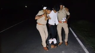 प्रयागराज में लुटेरे बदमाश शिवम पासी का पुलिस ने किया ये हाल, जब वो अस्पताल पहुंचा तो ऐसा था नजारा Prayagraj News