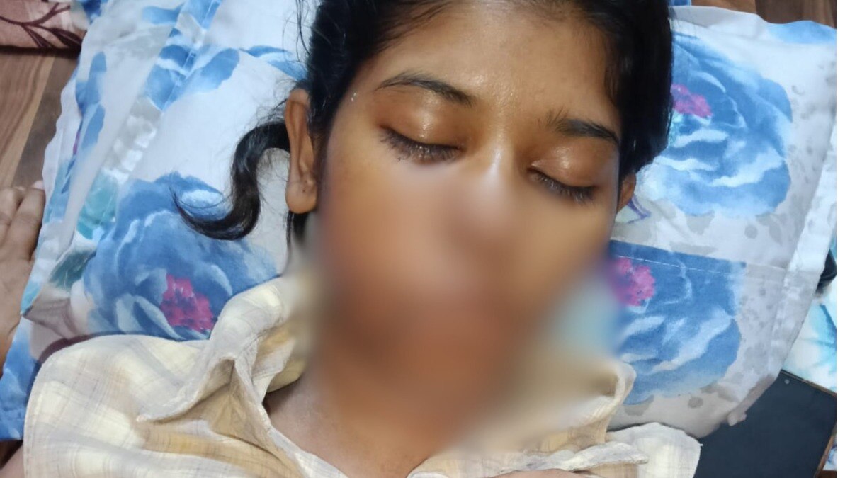 Kanpur Stray Dogs Attack News