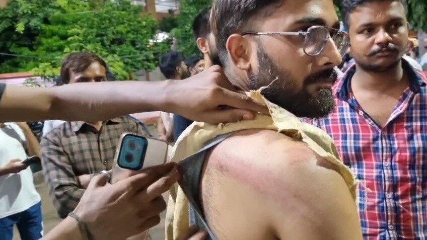 Barabanki, Ram Swaroop University, Lathi Charge