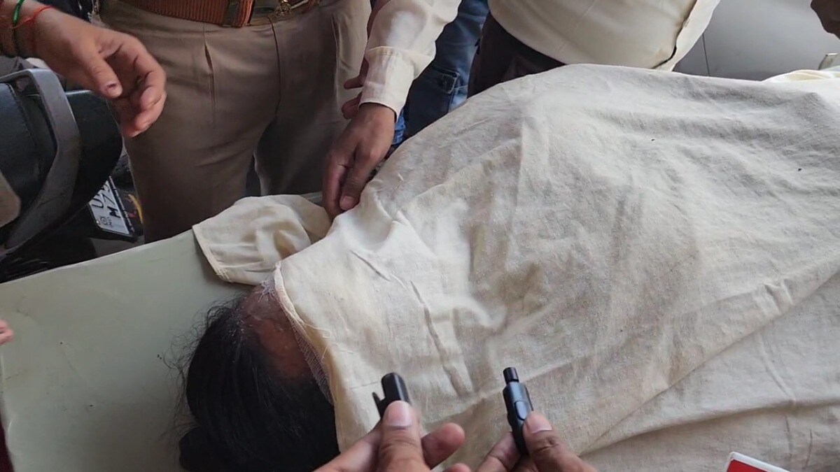 2 महीने बाद होनी थी शादी उससे पहले ही संभल की टीचर के चेहरे पर फेंका गया एसिड... जिसने ये दरिंदगी की वो कौन? Sambhal Crime News