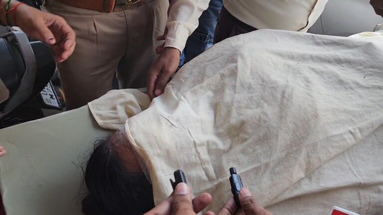 2 महीने बाद होनी थी शादी उससे पहले ही संभल की टीचर के चेहरे पर फेंका गया एसिड... जिसने ये दरिंदगी की वो कौन? Sambhal Crime News