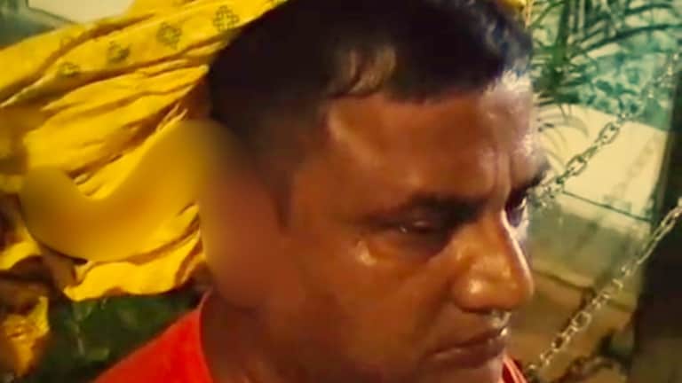 8 साल पहले की थी लव मैरिज, अब पत्नी ने पति अमित का कान ही चबा डाला, कानपुर का गजब मामला Kanpur, Kanpur News, Kanpur viral news, Kanpur police, Kanpur hindi news, up news, कानपुर, कानपुर न्यूज, कानपुर क्राइम, कानपुर वायरल न्यूज, यूपी न्यूज