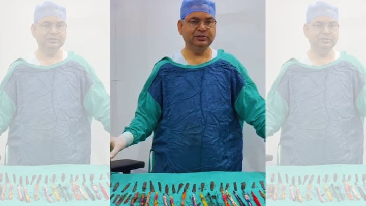 हापुड़ में सचिन के पेट से निकले 50 से ज्यादा ब्रश, पेन और चम्मच... कैसे आए ये सब अंदर? Hapur News