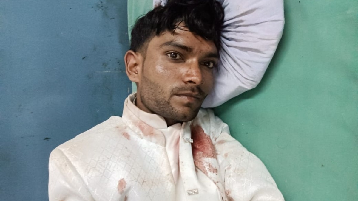 अमरोहा में बग्घी पर बैठे दूल्हे आकाश को ही जमकर पीट दिया गया, शादी के दिन किसने दिया उसे ये दर्द?
