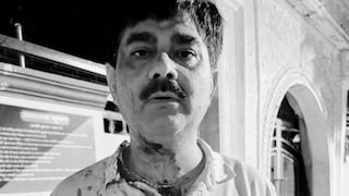 लखनऊ में डिप्टी CM ब्रजेश पाठक के स्टाफ कर्मी रवींद्र शुक्ला को लोहे की रोड से पीटा गया, किसने किया ये हमला  Lucknow Crime News