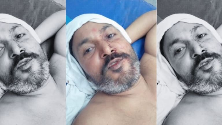 गाय परेशान हो रही पटाखे दूर जलाओ... झगड़े के बाद पिता ने दिया बेटे को पड़ोसी वकील पर गोली चलाने का आदेश, उसने झोंका फायर Lucknow Crime News