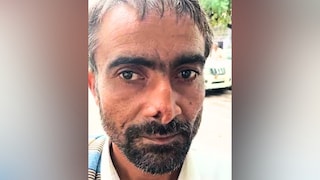 कटी नाक दिखा कानपुर के दिवारी लाल ने बताई 'नककटुआ' अलवर की बदमाशी, ऐसे करता है अटैक   UP Tak