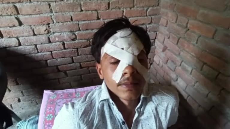 बागपत में नाबालिगों के गैंग ने जुबैर को दौड़ा-दौड़ाकर माथे पर घोंपा पर छूरा! माजरा क्या है? UP Tak