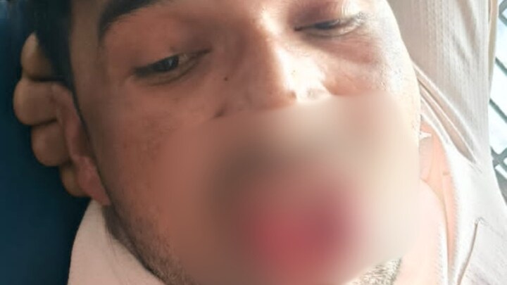 लड़की को जबरन किस कर रहा था चम्पा, उसने इतनी जोर से दांत से काटा कि अब कहीं मुंह दिखाने लायक नहीं रहा Kanpur, Kanpur News, Kanpur Crime News, Kanpur Police, Girl bites tongue in Kanpur, Girl bites young man's tongue, UP News, UP Crime, कानपुर, कानपुर न्यूज, कानपुर क्राइम न्यूज, कानपुर पुलिस, कानपुर में युवती ने काटी जीभ