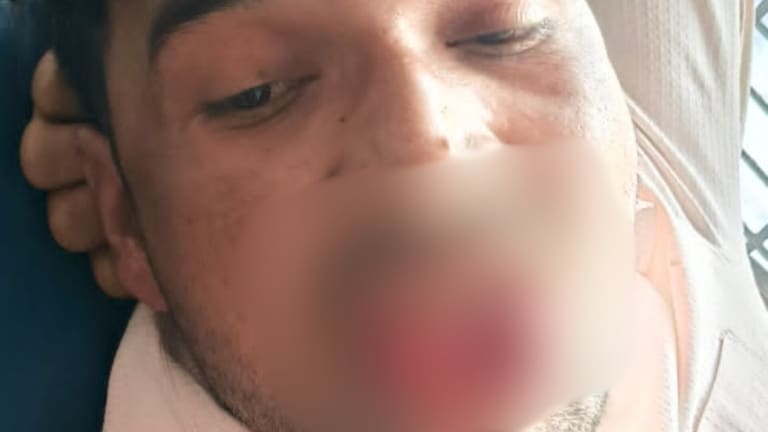 लड़की को जबरन किस कर रहा था चम्पा, उसने इतनी जोर से दांत से काटा कि अब कहीं मुंह दिखाने लायक नहीं रहा Kanpur, Kanpur News, Kanpur Crime News, Kanpur Police, Girl bites tongue in Kanpur, Girl bites young man's tongue, UP News, UP Crime, कानपुर, कानपुर न्यूज, कानपुर क्राइम न्यूज, कानपुर पुलिस, कानपुर में युवती ने काटी जीभ