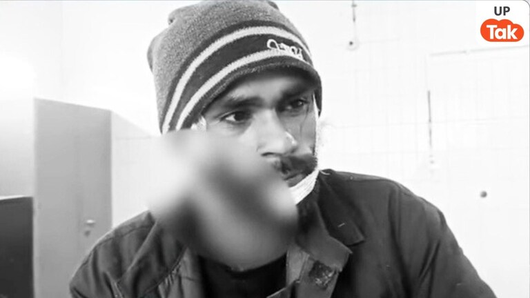 महोबा जेल में गैंगस्टर कमलेश का गाल कौन चबा गया! ठंड की ये जंग उसे खूनमखून कर गई UP Tak