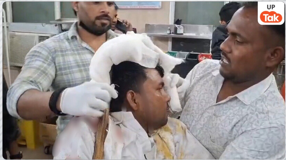 axe stuck in head