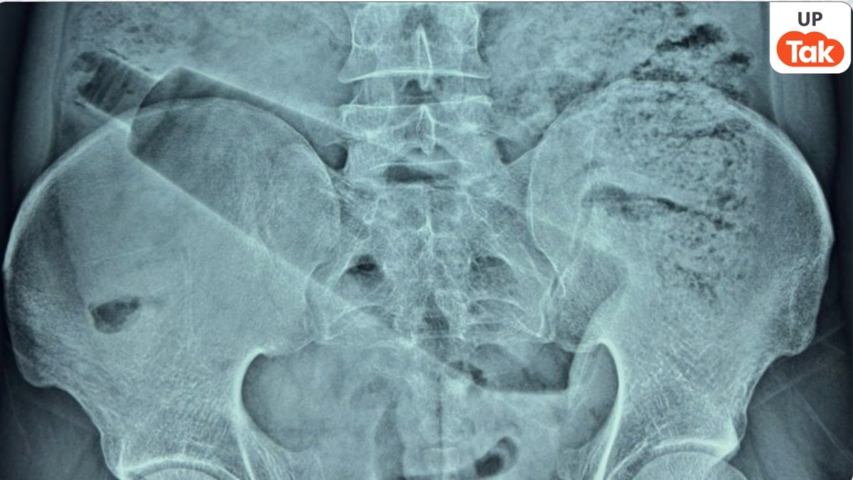 Ambedkar Nagar, Ambedkar Nagar news, Ambedkar Nagar viral news, up news, up viral news, अम्बेडकर नगर, अम्बेडकर नगर न्यूज, अम्बेडकर नगर वायरल न्यूज, यूपी न्यूज