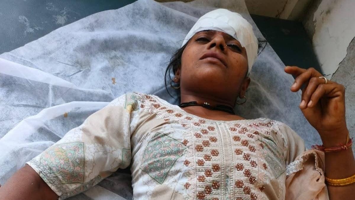 Mathura Road Accident News: मथुरा में दर्दनाक हादसा: देवी दर्शन को जा रहे श्रद्धालुओं की पिकअप पलटी, एक की मौत; 8 गंभीर रूप से घायल